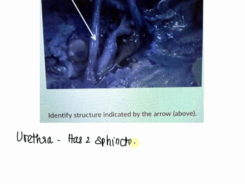 identify-structure-indicated-by-the-arrow-above-54293