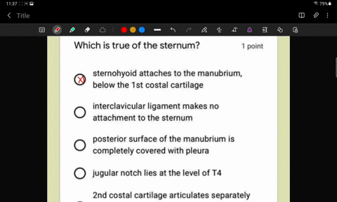 which-is-true-of-the-sternum-point-sternohyoid-attaches-to-the-manubrium-below-the-ist-costal-cartilage-interclavicular-ligament-makes-no-attachment-to-the-sternum-posterior-surface-of-the-m-95604