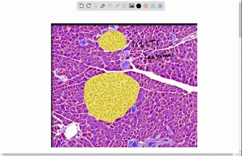 identify-the-structure-and-cell-types-highlighted-in-blue-on-this-image-note-the-highlighting-will-disappear-and-reappear-every-2-seconds-80247