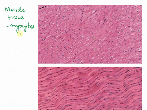 the-most-common-cells-in-this-tissue-type-are-and-the-two-fibers-inthis-strong-but-flexible-tissue-are-the-name-of-this-tissue-is-it-contains-cells-called-and-many-many-fibers-called-the-nam-38762