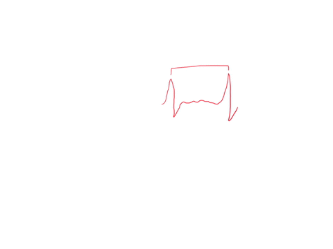 assuming-25-mmsec-what-is-the-approximate-heart-rate-from-the-below-ecg-trace-nb-1-large-box-5-mm-o-a-75-beats-per-minute-o-b-45-beats-per-minute-o-c-90-beats-per-minute-o-d-60-beats-per-min-43013
