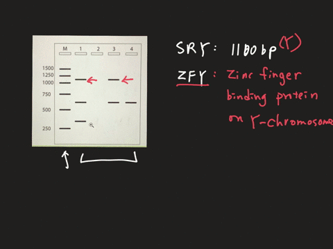 below-is-an-image-of-an-agarose-gel-following-dna-electrophoresis-the-marker-m-lane-is-shown-as-well-as-four-wells-to-which-four-different-pcr-samples-were-added-these-pcr-samples-resulted-f-21159