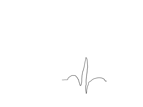 when-viewing-and-ecg-the-t-wave-represents-which-phase-of-the-cardiac-cycle-a-atrial-depolarization-b-contraction-of-the-ventricles-c-repolarization-of-the-ventricles-d-opening-of-the-valves