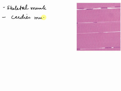 question-27-above-identify-the-tissue-seen-skeletal-muscle-cardiac-muscle-dense-regular-connective-smooth-muscle-50165
