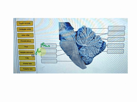 v-part-a-drag-the-appropriate-labels-to-their-respective-targets-reset-help-fourth-ventricle-cerebellar-cortex-arborvitae-pons-medufla-obionoata-folia-anterior-lobe-postenor-lobe-submit-requ-26135