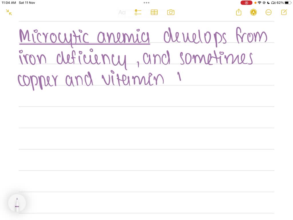 SOLVED Which type of anemia develops from iron, copper, and vitamin B6
