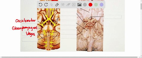 click-and-drag-each-label-from-above-to-its-correct-position-on-the-illustration-below-trochlear-nerve-accessory-nerve-facia-nerve-ollactory-iract-hypoglossal-nerve-grossopiaryngua-ncr-abduc-24093