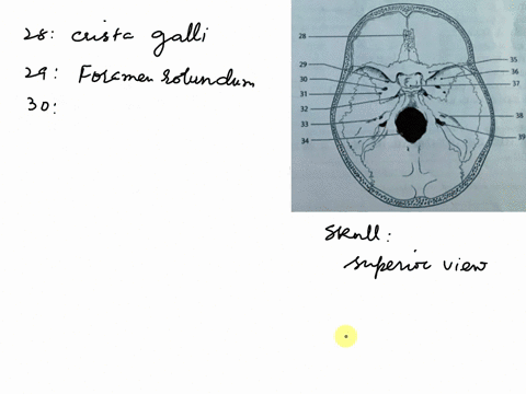 questions-2839in-the-following-diagram-identify-the-labeled-bony-markings-color-the-bones-with-the-indicated-colors-frontalyellow-sphenoid-purple-temporal-red-ethmoid-green-28-occipitalorang-23094
