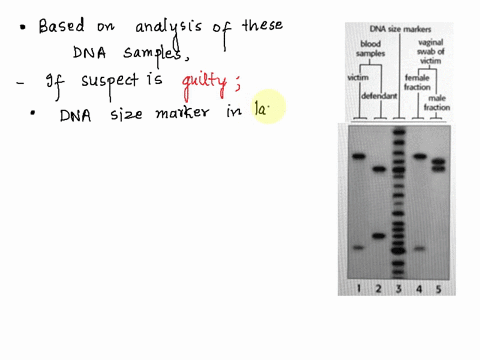 20-the-key-portion-of-the-autoradlograph-rom-a-single-locus-probe-point-analysis-of-various-dna-samples-in-rape-investigation-is-shown-in-the-figure-to-the-right-samples-of-dna-were-loaded-i-47647