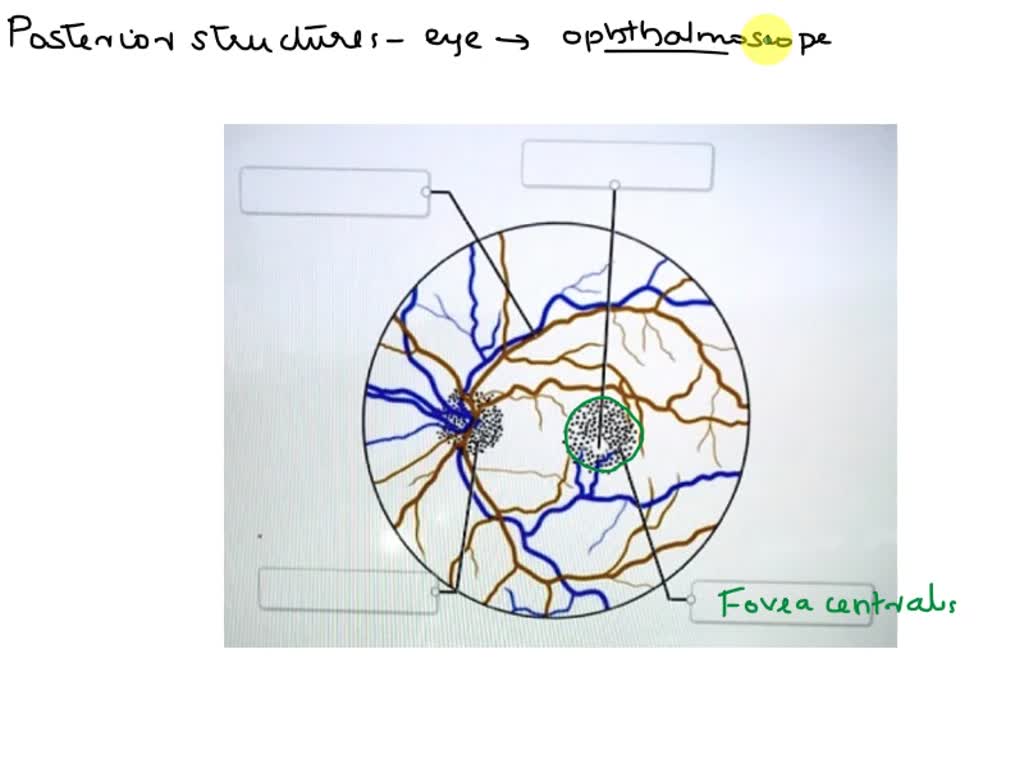 SOLVED Label the posterior structures of the eye as they would be