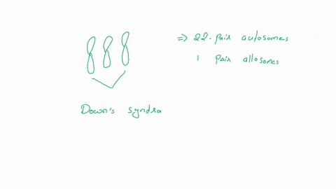 diagnosis-down-syndrome-down-syndrome-turner-syndrome-klinefelter-syndrome-xyy-10315