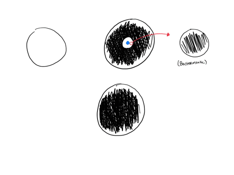 being-killed-by-an-antibiotic-or-if-its-growth-is-simply-how-can-you-determine-if-bacterium-is-being-inhibited-larger-zone-of-inhibition-whereas-if-it-is-inhibited-it-if-the-organism-is-bein-40727