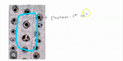 what-phase-of-the-cell-cycle-are-the-two-circled-cells-displaying-interphase-prophase-anaphase-metaphase-telophase-37318