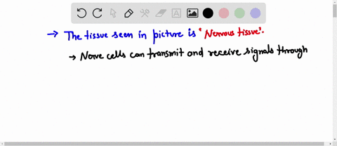 identify-the-tissue-the-image-then-drag-each-label-into-the-appropriate-position-to-indicate-whether-the-statement-is-true-or-false-about-the-tissue-forms-the-lining-of-tha-digostve-tract-ca-65466