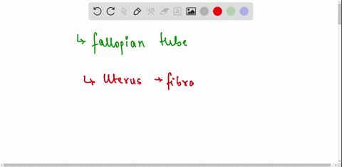 which-part-of-the-female-reproductive-system-is-highlighted-below-a-fallopian-tube-b-ovary-c-uterus-d-cervix-19354