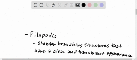 amoeboids-move-about-and-feed-by-means-of-pseudopodia-describe-the-4-kinds-of-pseudopodia