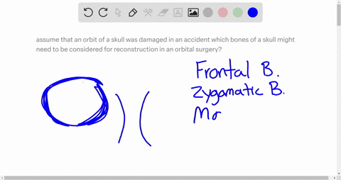 assume-that-an-orbit-of-a-skull-was-damaged-in-an-accident-which-bones-of-a-skull-might-need-to-be-considered-for-reconstruction-in-an-orbital-surgery-97936