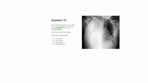 question-15-33-y-old-female-presents-to-your-office-with-coughing-chest-pain-fever-and-difficulty-breathing-chest-mathrmx-ray-shows-the-following-what-is-the-most-likely-dx-a-pneumonia-b-lung-cancer-c