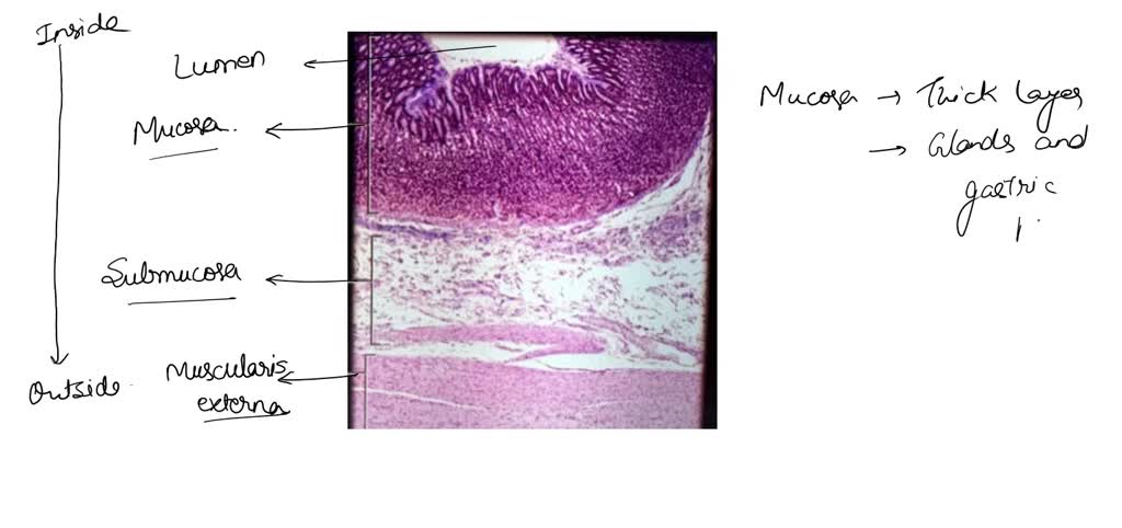 SOLVED: Histology of the Esophagus Label the following: - Stratified ...