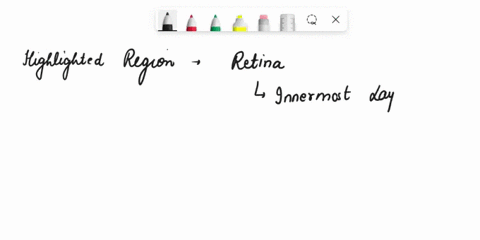 item-45-which-structure-is-highlighted-choroid-optic-disc-retina-fovea-centralis-87754