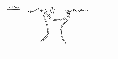 sketch-each-of-the-following-structures-mycelium-ascus-with-ascospores-zoospore-zygospore-basidium-3-10041