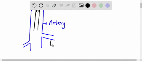 activity-2-review-the-anatomy-of-blood-vessels-using-the-figure-below-and-your-textbook-label-the-tissues-that-make-up-blood-vessels-and-identify-arteries-arterioles-capillaries-venules-and-47313