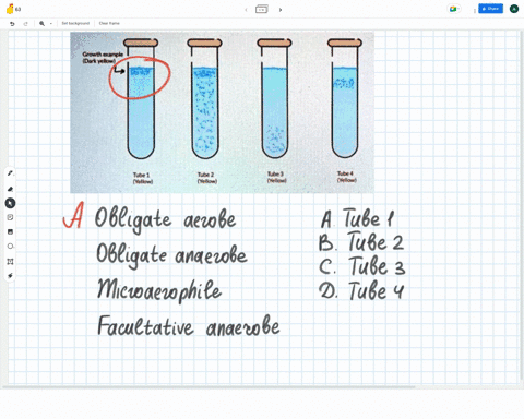growth-example-dark-yellow-tube1-yellow-tube2-yellow-tube3-yellow-tube4-yellow-in-the-image-abovewhich-tube-is-an-obligate-aerobeobligate-anaerobemicroaerophileand-facultative-anaerobe-v-obl-99933