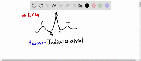 which-statement-about-the-normal-electrocardiogram-ecg-tracing-is-false-a-the-t-wave-represents-depolarization-of-the-atria-b-the-qrs-wave-represents-depolarization-of-the-ventricles-c-the-r-79373