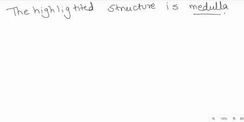 which-structure-is-highlighted-multiple-choice-cnvi-abducens-nerve-cnix-glossophalyngeal-neive-cn-iiv-vesubulocochicar-nerve-60922