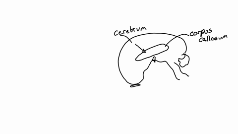 which-of-the-following-statements-about-the-corpus-callosum-is-false-the-corpus-callosum-is-inferior-to-the-cerebrum-the-corpus-callosum-is-anterior-to-the-brainstem-the-corpus-callosum-is-l-25704