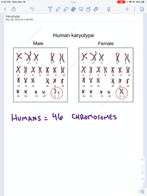 a-human-karyotype-showing-22-pairs-of-autosomes-and-two-x-chromosomes-would-be-select-one-normal-female_-b-an-abnormal-female-normal-male_-an-abnormal-male-none-of-these-09657