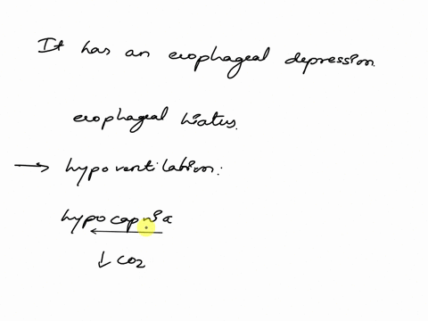 22-which-is-not-correct-about-the-left-lung-c-it-is-slightly-smaller-than-the-right-lung-c-it-has-a-cardiac-impression-c-it-has-a-cardiac-notch-c-it-has-2-lobes-and-1-fissure-it-has-an-esoph-75693