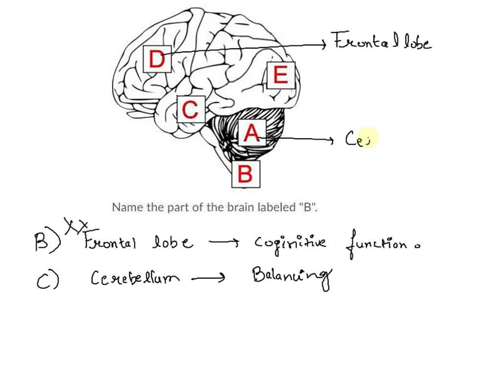 SOLVED 'Name the part of the brain labeled "B". Question 17 options A