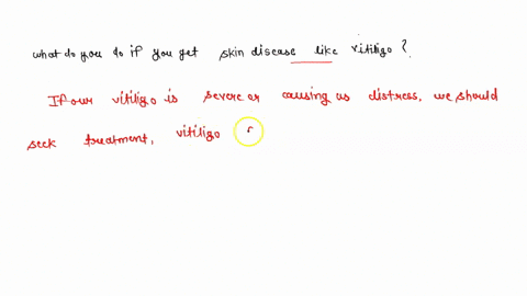 what-do-u-do-if-u-get-skin-disease-like-vitiligo-26574