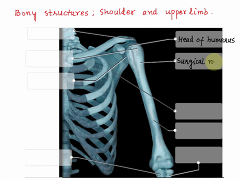 label-the-bony-structures-of-the-shoulder-and-upper-limb-radius-scapula-surgical-neck-head-of-humerus-greater-tubercle-humerus-acromion-process-of-scapula-glenoid-cavity-of-scapula-ulna-rese-23376
