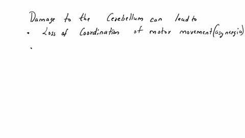 13-if-the-cerebellum-was-damaged-as-a-result-of-trauma-what-effect-would-thisperson-likely-to-experiencea-rapid-breathingb-changes-in-body-temperaturec-trouble-in-maintaining-balanced-partia-96045