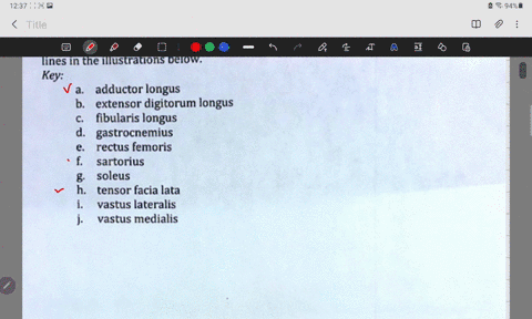 of-the-lower-limb-identify-all-muscles-provided-with-leader-using-the-terms-from-the-key-below-correctly-lines-in-the-illustrations-below-key-adductor-longus-extensor-digitorum-longus-fibula-25802