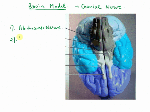 identify-the-cranial-nerves-on-this-inferior-view-of-a-brain-model-trochlear-nerve-trigeminal-nerve-optic-nerve-abducens-nerve-olfactory-tract-oculomotor-nerve-86306