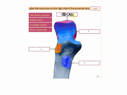 label-the-structures-on-the-right-side-of-the-proximal-ulna-4-pts-label-the-structures-on-the-right-side-of-the-proximal-ulna-4-pts-olecranon-process-radial-notch-trochlear-notch-ulnar-tuber-55401