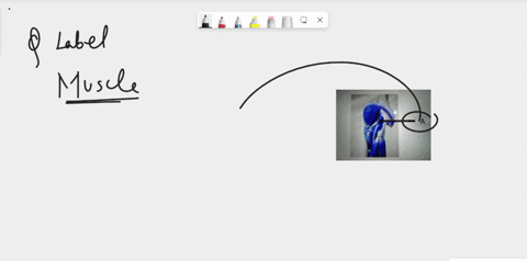 26-name-the-muscle-ashown-in-the-figure-question-name-the-muscle-ashown-in-the-figure-alt-f30-p-23764