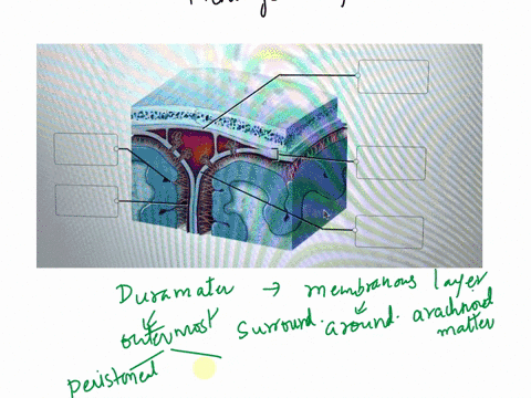 identify-the-meningeal-structures-shown-arachnoid-mater-dura-mater-periosteal-layer-dura-mater-meningeal-layer-pia-mater-dura-mater-resot-zoom-46707
