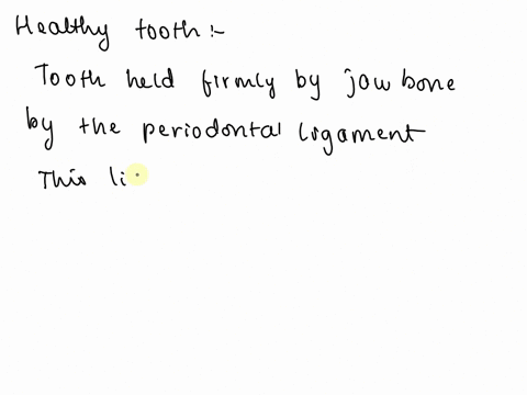 a-healthy-tooth-is-held-firmly-in-the-join-and-by-the-79092