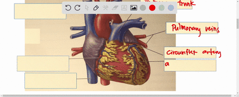 1-label-the-following-parts-of-the-heart-on-figure-1232-anterior-interventricular-artery-aorta-circumflex-artery-inferior-vena-cava-pulmonary-trunk-pulmonary-veins-right-coronary-artery-supe-90385