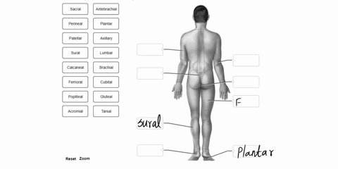 labe-the-body-parts-with-the-proper-djective_-sacral-antebrachial-perineal-plantar-patellar-axillary-sural-lumbar-calcaneal-brachial-femoral-cubital-popliteal-gluteal-acromial-tarsal-reset-z-92031