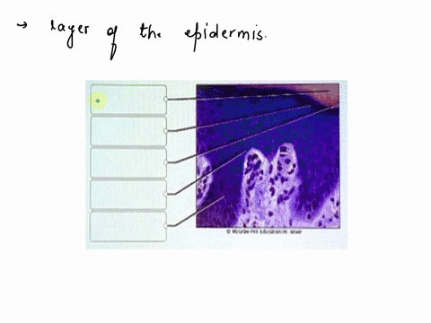 intepumentaty-system-hw-idenbly-ihe-layers-ol-the-enidermis-each-lbel-wil-be-used-inke-8-sttakutt-eonoumi-stutum-cngum-stratum-rckum-suatum-granulosum-slealut-basule-66342