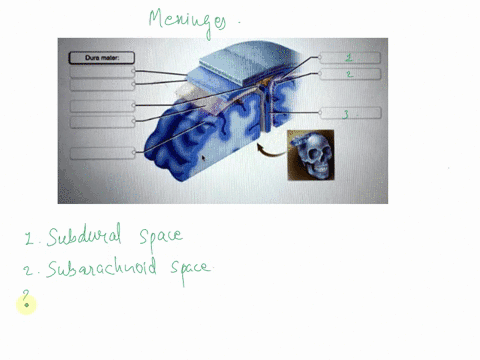 dura-mater-dura-mater-meningeal-layer-arachnoid-villus-correctly-label-the-following-meninges-of-the-brain-subarachnoid-space-pia-mater-arachnoid-mater-falx-cerebri-periosteal-layer-reset-zo-49513