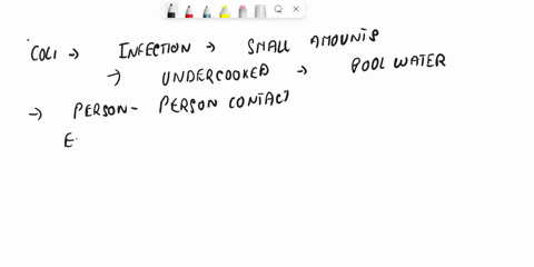 complete-the-following-statements-concerning-fetal-and-infant-skeletal-developmentinsert-the-missing-words-in-the-answer-blanks-1-soft-spotsor-membranous-joints-calledin-the-fetal-skullallow-90214