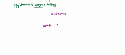 you-performed-a-blood-typing-activity-as-described-in-the-lab-manual-you-observed-agglutination-clumping-with-anti-b-and-anti-rh-serum-based-on-the-test-results-you-can-conclude-that-the-blo-71465