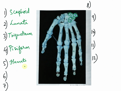 numbered-on-this-anterior-view-of-the-right-hand-by-placing-the-correct-numbers-in-the-spaces-provided-a2-jjphotography-capitate-pisiform-distal-phalanges-proximal-phalanges-hamate-scaphoid-90465