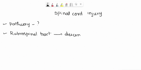 your-patient-suffers-from-spinal-cord-injury-that-has-left-her-absent-of-muscle-tone-in-her-lower-limbs-this-may-indicate-injury-to-what-pathway-a-corticospinal-b-rubrospinal-c-reticulospina-20296